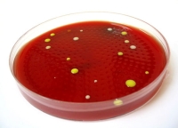 bacteria in a petri dish